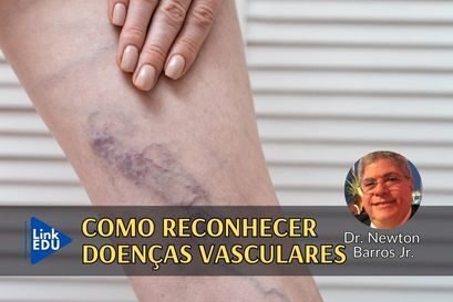 Doenças venosas são arriscadas