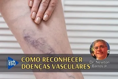 Doenças venosas são arriscadas